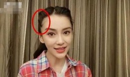 明星大爆料掉头发视频大全,脱发真相揭秘，视频大全带你一探究竟